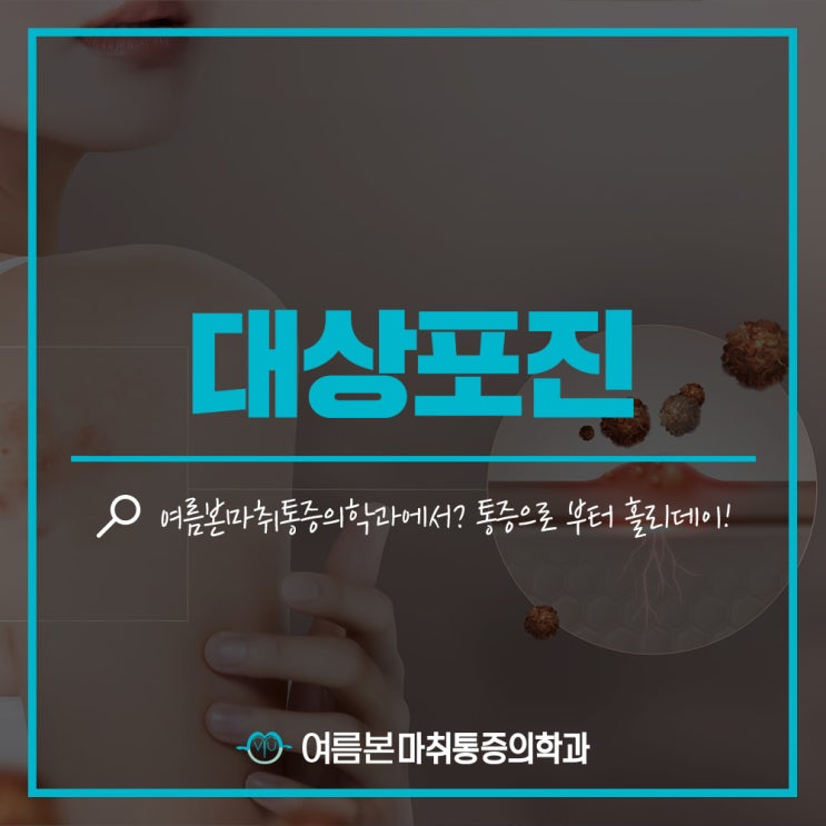  도곡통증의학과 대상포진 증상 치료법