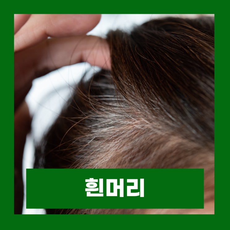  흰머리 나는 이유 새치 뽑으면 안되는 이유 탈모 원인