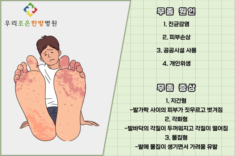 의정부 무좀 병원 어느 병원으로 가야할까?