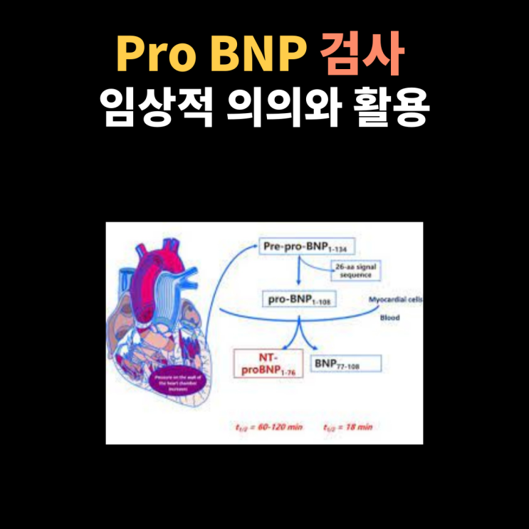  Pro BNP, NT-proBNP (프로 B형 나트륨이뇨펩타이드) 정의, 수치, 검사에 대한 이해