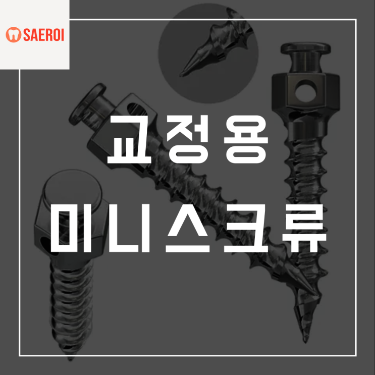  교정용 미니스크류가 뭔가요? 주의사항과 부작용