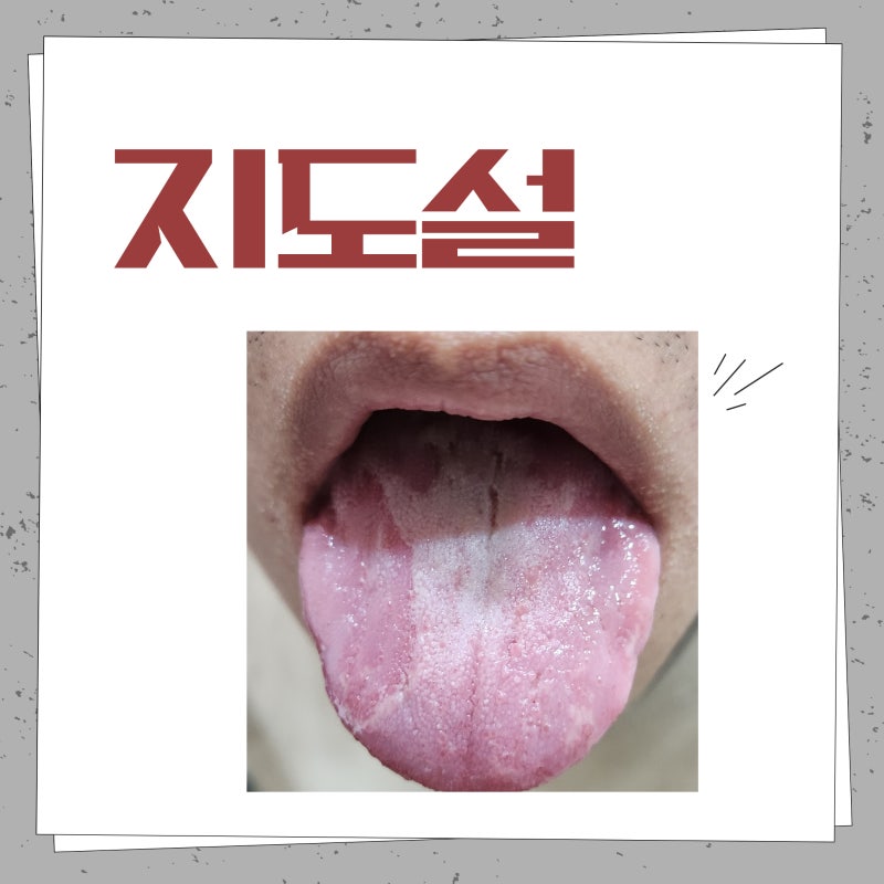 지도혀 지도설이 의미하는 것