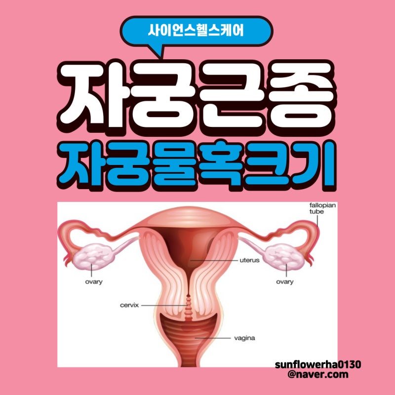 자궁근종 자궁 물혹 크기 수술 비용 실비 청구 가능할까?