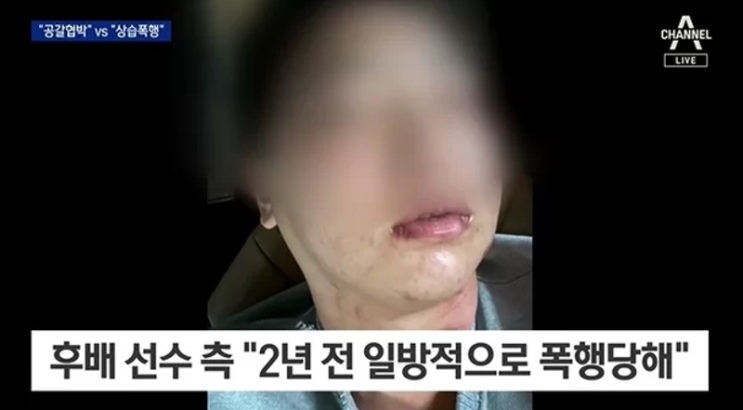 "<b>김하성</b>이 <b>상습폭행</b>", 후배 임혜동이 공개한 사진, '가정폭력... 