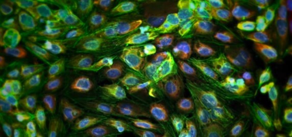  Organoid Matrigel Matrix 실험 방법