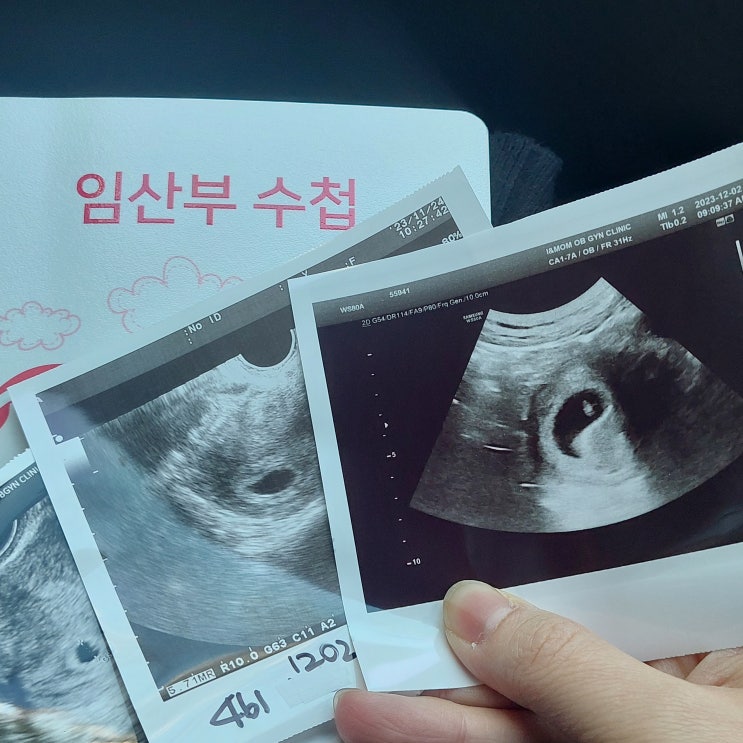  임신 6주차 증상, 점점 심해지는 입덧 그리고 심장소리 확인!