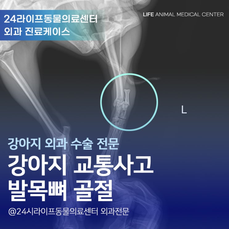 강아지 교통사고, 좌측 후지 발목뼈 골절 수술 : 대구수술전문동물병원 강아지 교통사고, 좌측 후지 발목뼈 골절 수술 : 대구수술전문동물병원