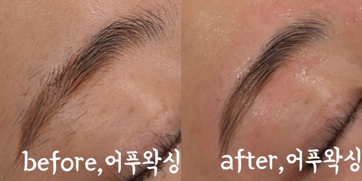  울산 중구 브라질리언 왁싱 어푸왁싱 아프지않아요 오히려 시원해요