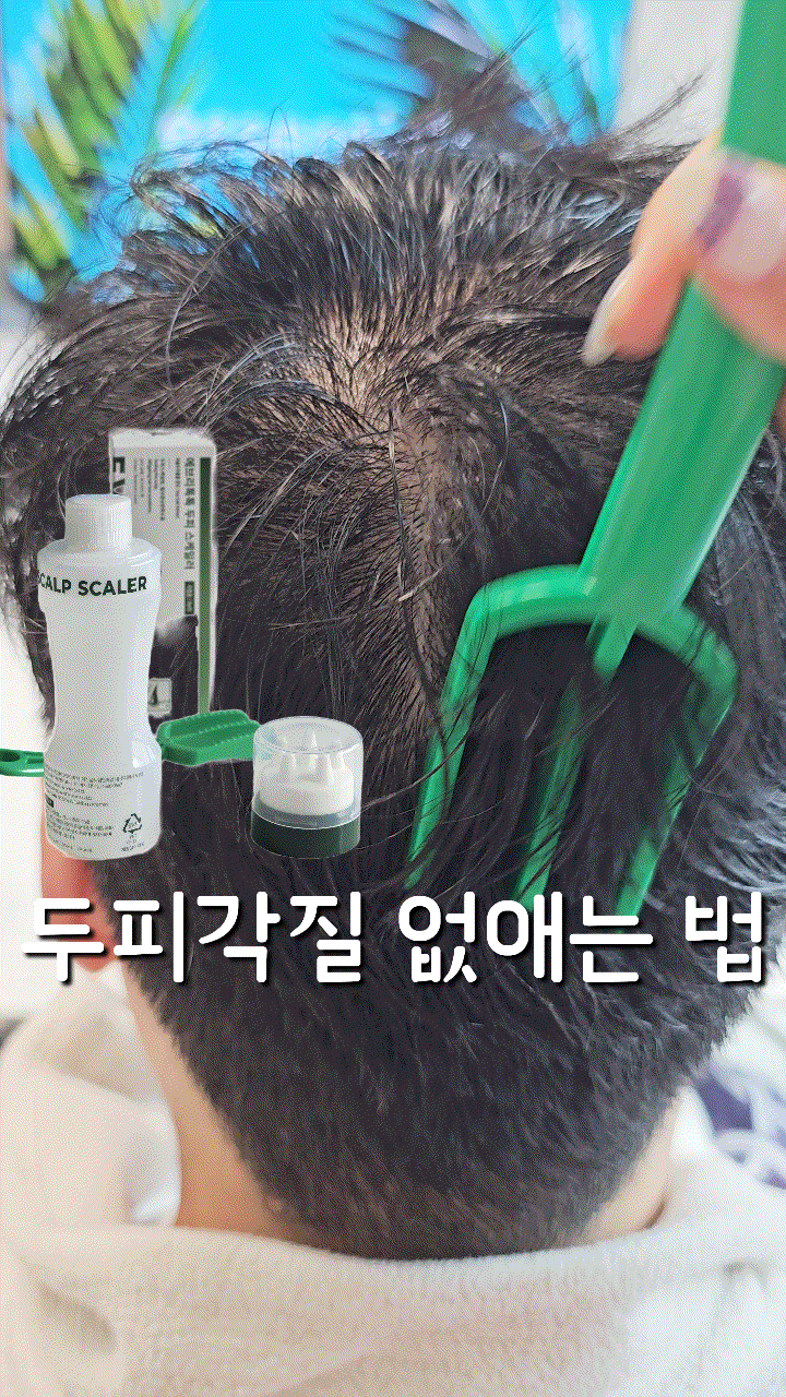  비듬 없애는 방법, 간편하게 각질 녹이는 에브리톡톡 두피 스케일러