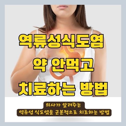  역류성식도염을 병원 안가고 약 안먹고 치료하는 방법 - 증상 | 원인 | 약 | 근본 치료