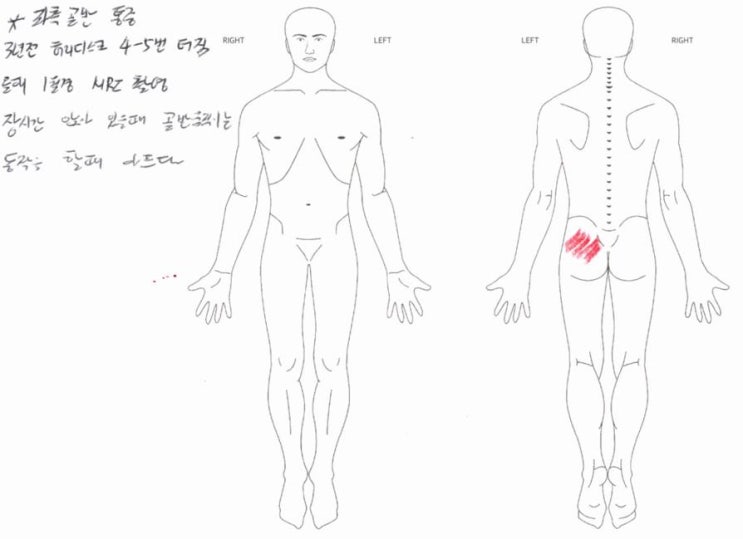  좌골신경통 원인, 병원에 가도 낫질 않아요