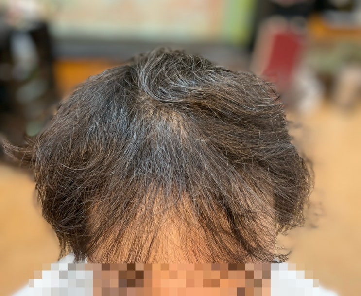  해운대 총각도 반해버린 탈모 커버 성형 펌 부산사상르네시떼미용실탈모모발케어전문