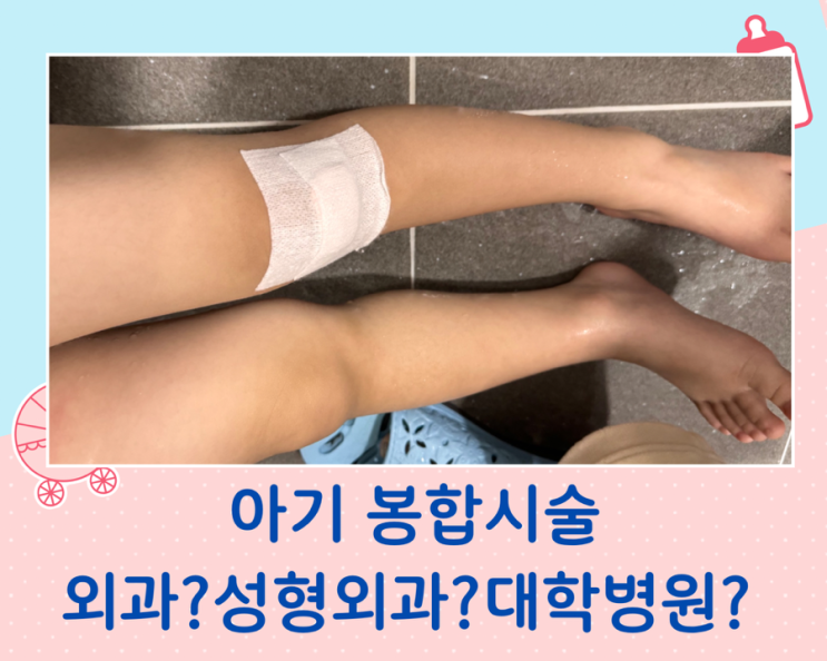 아기 봉합시술 소아과? 외과? 성형외과? 대학병원?