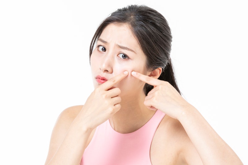 비립종셀프압출 해도 될까?