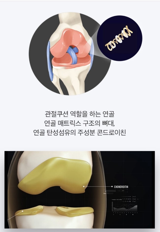 콘드로이친 정보 비교 콘드로이친1200 소연골 상어연골 차이 관절 영양제 추천