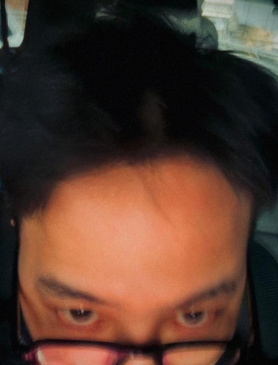 '<b>마약</b> 의혹 부인' <b>지드래곤</b>, 잘린 머리카락 공개→경찰 "혐의... 
