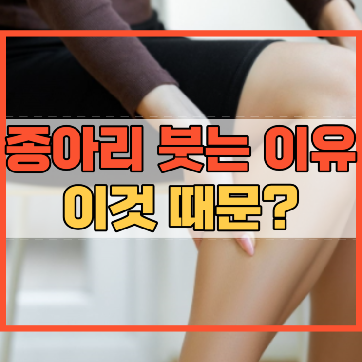  종아리 붓는 이유 이것 때문이었어?