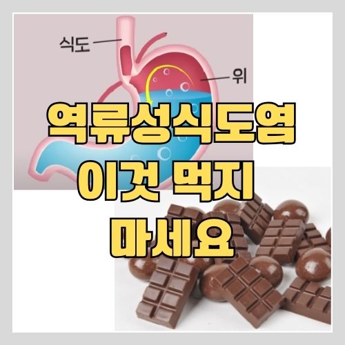  한의사가 알려주는 역류성식도염과 위염에 나쁜 음식 9가지는 꼭 알고 계세요!