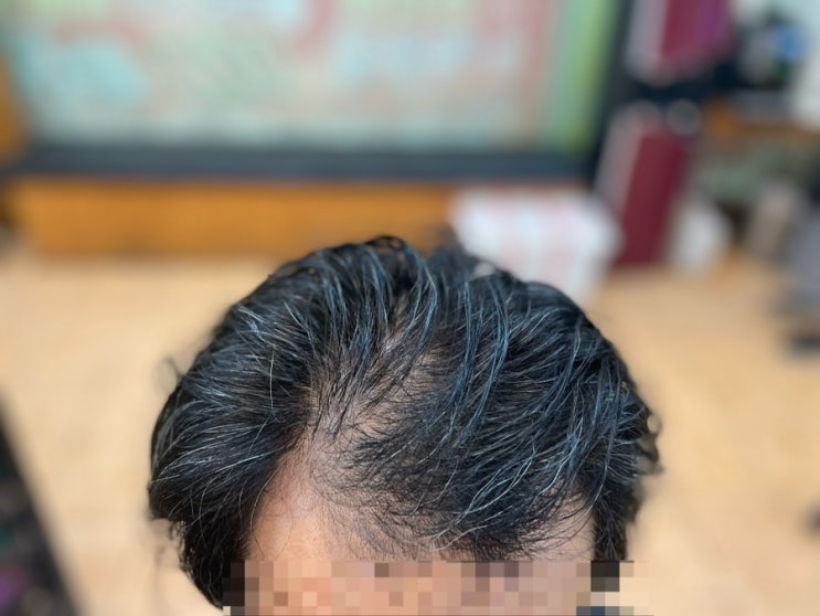  M자 탈모 정수리 탈모 필수 시청 부산사상르네시떼6층미용실 탈모 커버 펌