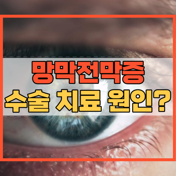  망막전막증 수술 치료 증상 원인 뭘까?