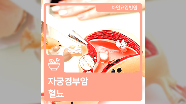  여자 소변에피 어떤 질환의 징조일까요?