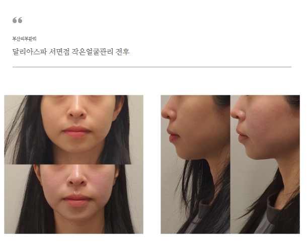  부산 약손명가 브랜드 달리아 스파 에스테틱 리뷰(by 채루)