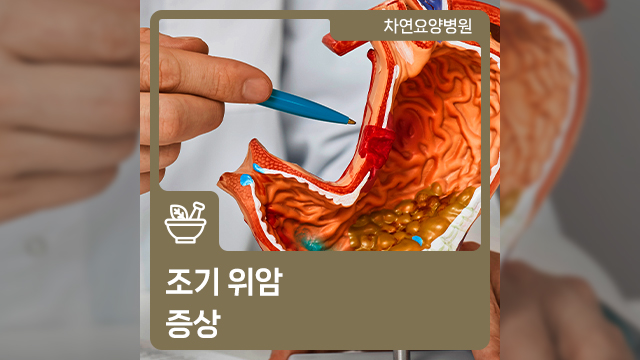  조기 위암 증상 발견하기 어려워, 사소한 증상에도 민감하게
