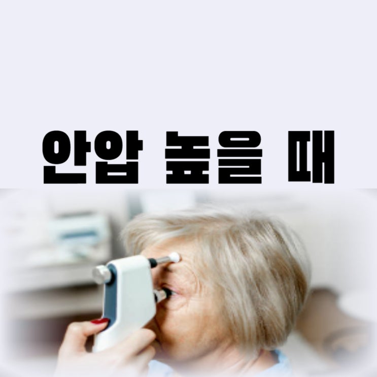  안압 높을 때 증상 치료 안약 안압 낮추는 법 어떤 것이 있을까