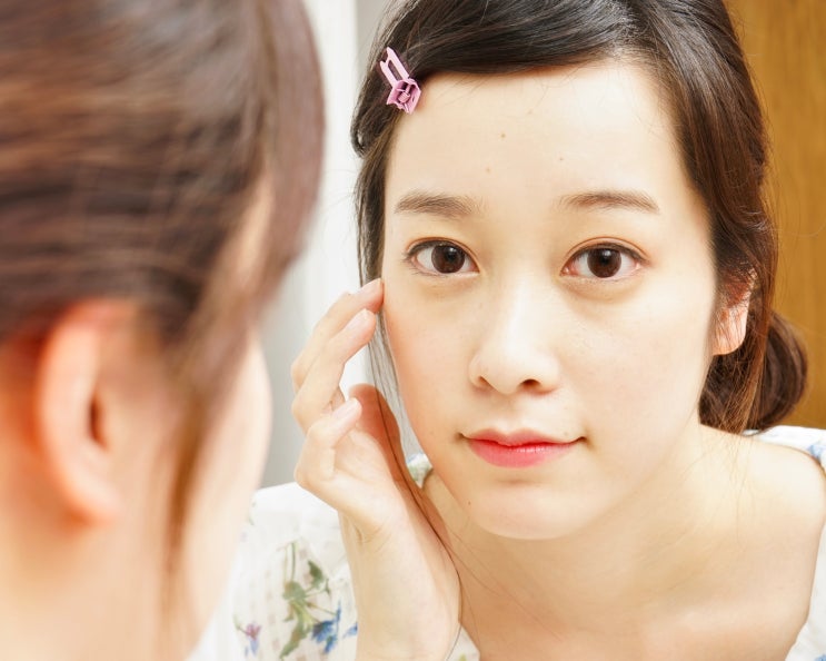  여드름 흉터 제거 레이저 원리, 비용, 주의 준비 사항