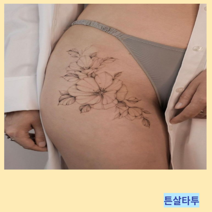 튼살 원인 및 튼살타투 커버 가격 정보 튼살 원인 및 튼살타투 커버 가격 정보
