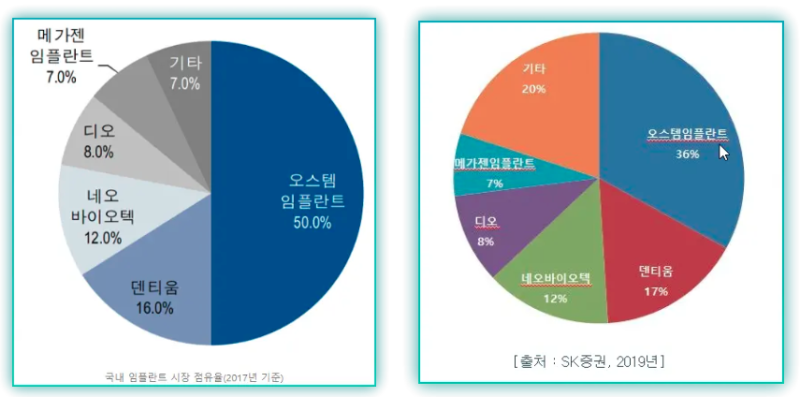 국산 임플란트 브랜드 순위 가격 총정리 (ft. 덴티움, 네오, 디오, 메가젠)