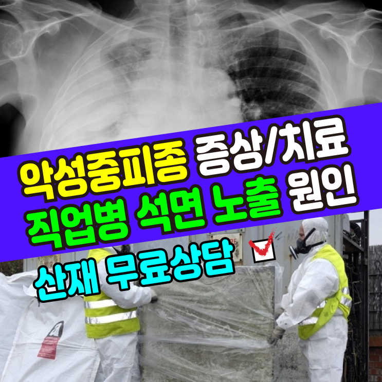  [기본정보] 악성중피종(증상,치료,원인)/ 석면 직업병 산재 무료상담