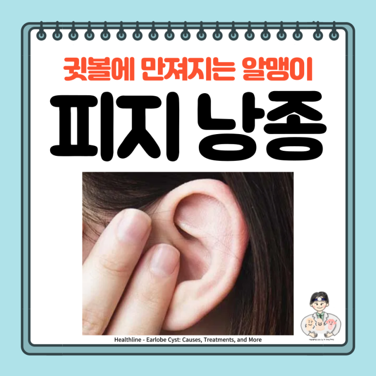  귓볼 몽우리 피지 낭종, 귓불 염증, 원인 증상 치료