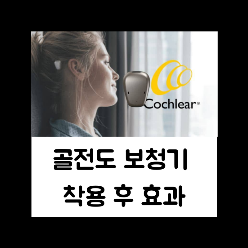 골전도 보청기 착용 후 효과