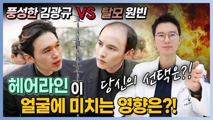  풍성한 머리의 김광규 VS 탈모 원빈 당신의 선택은? 모발이식병원 한올성형외과 김태훈 원장님