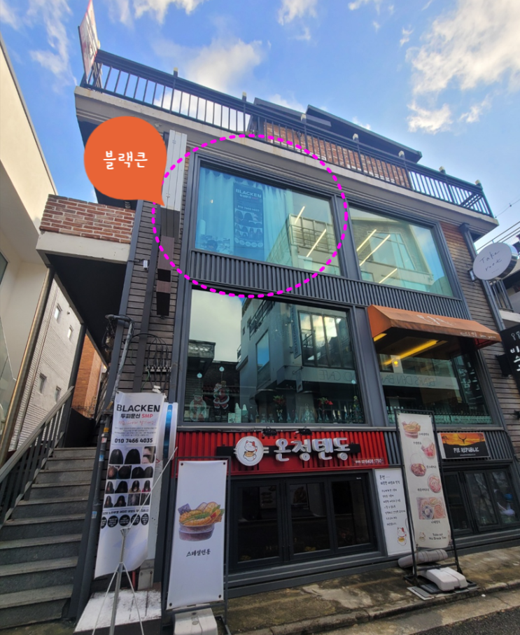  홍대두피 블랙큰 두피채움 통증정도 가르마채움
