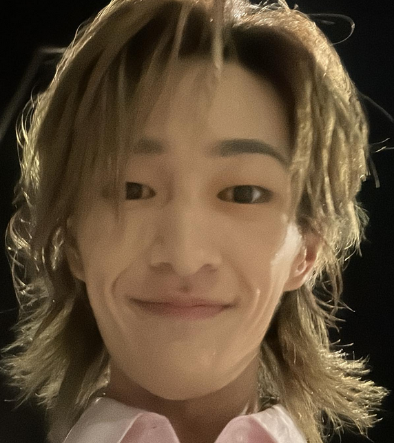  온유 병 근황 건강 얼굴 논란