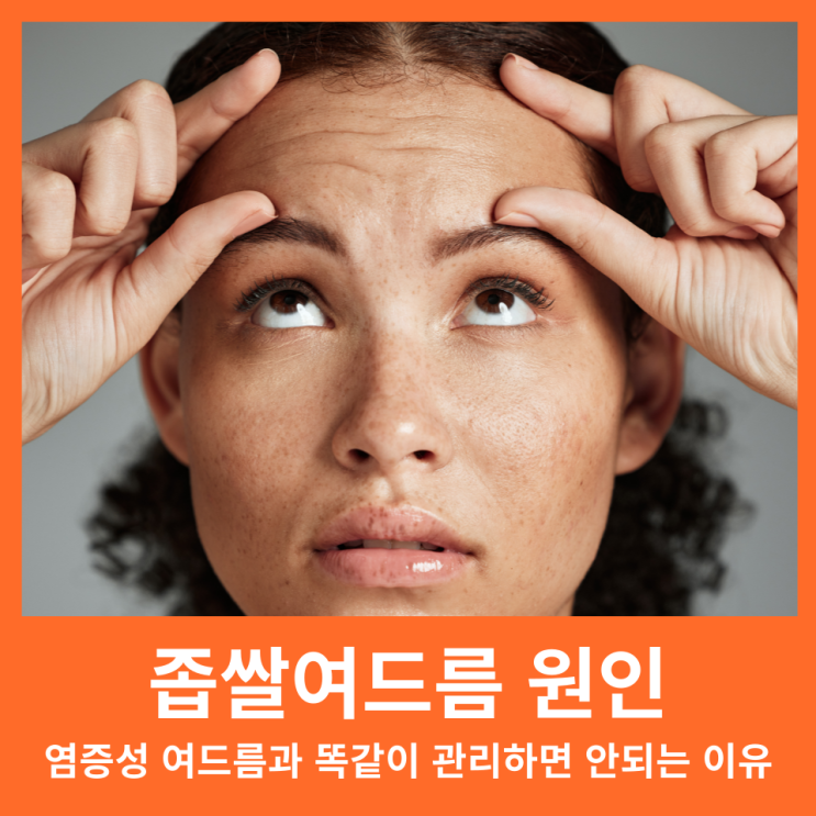  이마 턱 좁쌀여드름 원인, 염증성 여드름과 똑같이 관리하면 안됩니다.