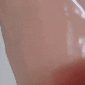  히루스카 피부미백크림 겸 색소침착 연고를 발라보았어요