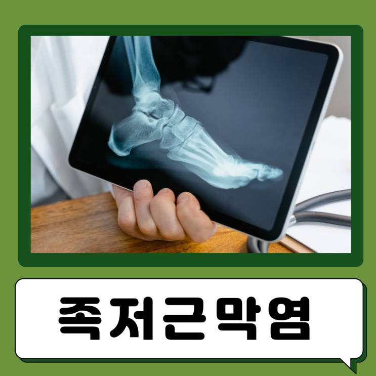  족저근막염 치료방법 발바닥 근막염 원인 증상 발뒤꿈치 통증