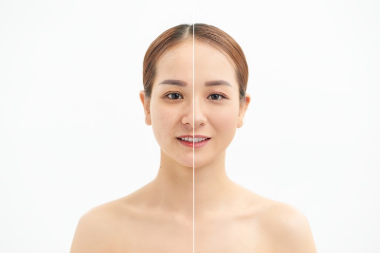  고순도NMN 리쥬브코어 NMN 99.9 프테로스틸벤 알아보자