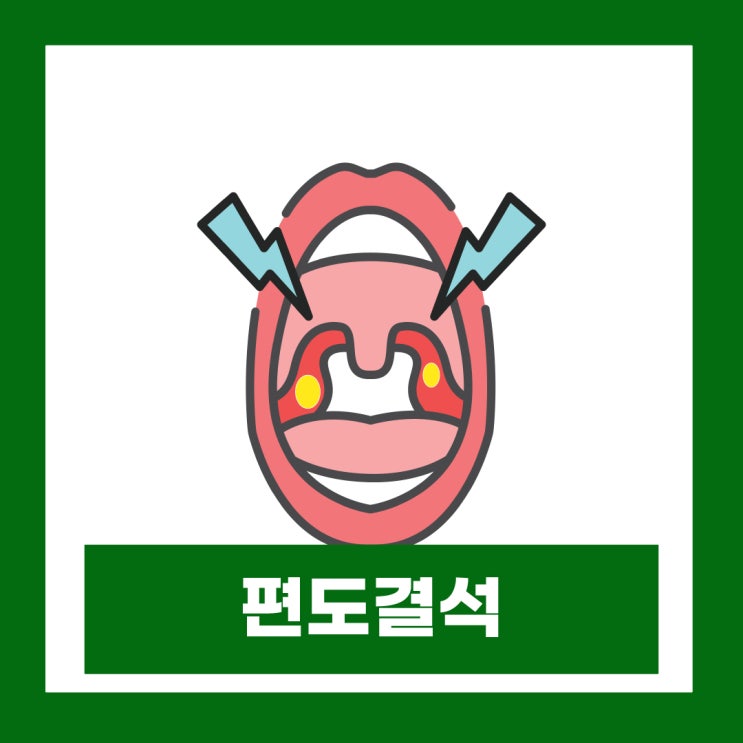  편도결석 제거기 집에서 쉽게 빼는법 원인 증상 제거