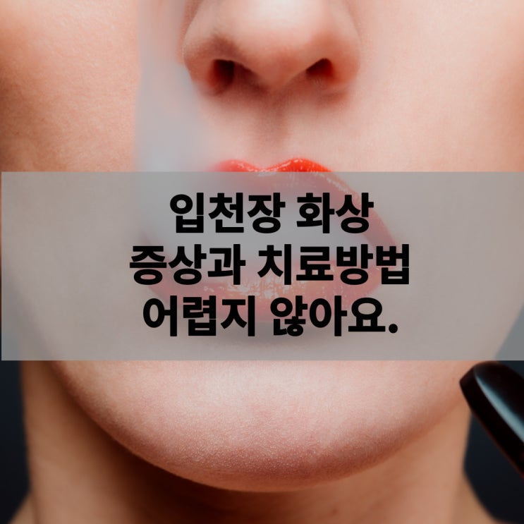 입천장 화상 간단하게 치료하는 방법