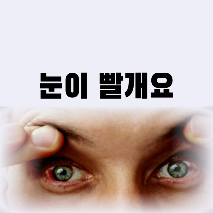  눈이 빨개요 이유가 무엇일까