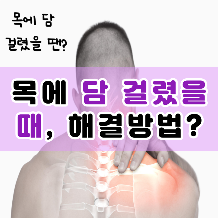  목에 담 걸렸을 때 어떻게 해야 하나요?