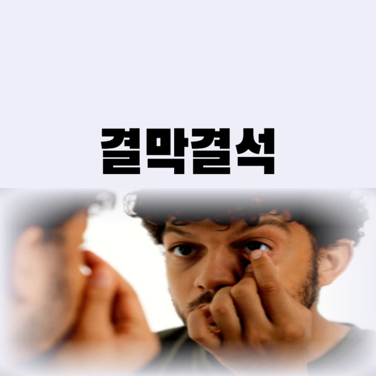  눈 결막결석 이물감 원인 제거까지
