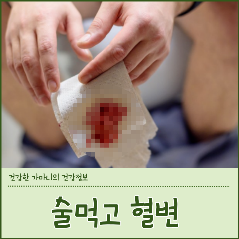 술먹고 혈변 피똥 음주후 혈변 보았다면 도대체 무슨일이야
