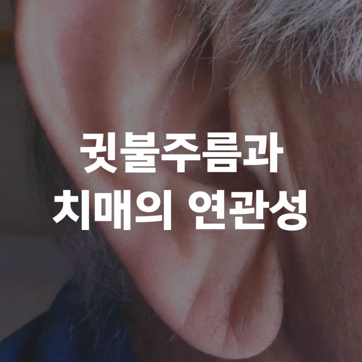 <b>이경규</b> 귓불 주름 치매 <b>위험</b>. 귓불 주름과 치매 연관성 과연?