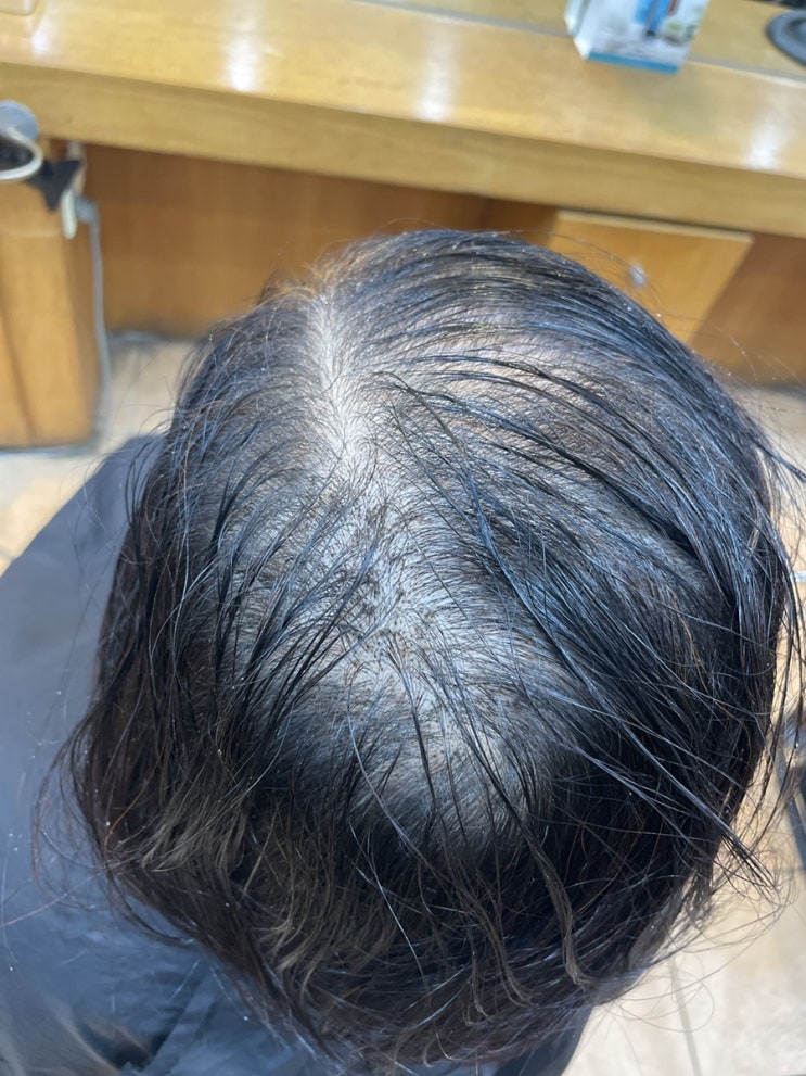  여자탈모펌 입금전 입금후 부산탈모 전문 르네시떼 사상6층미용실