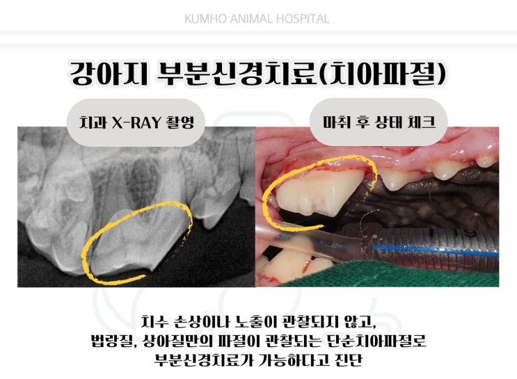  광주 강아지 치과 - 부러진 치아 발치 안하고 치료 하는 방법 [광주 치과 동물병원, 금호동 동물병원, 강아지 신경치료, 강아지 부분신경치료, 강아지 치아파절]